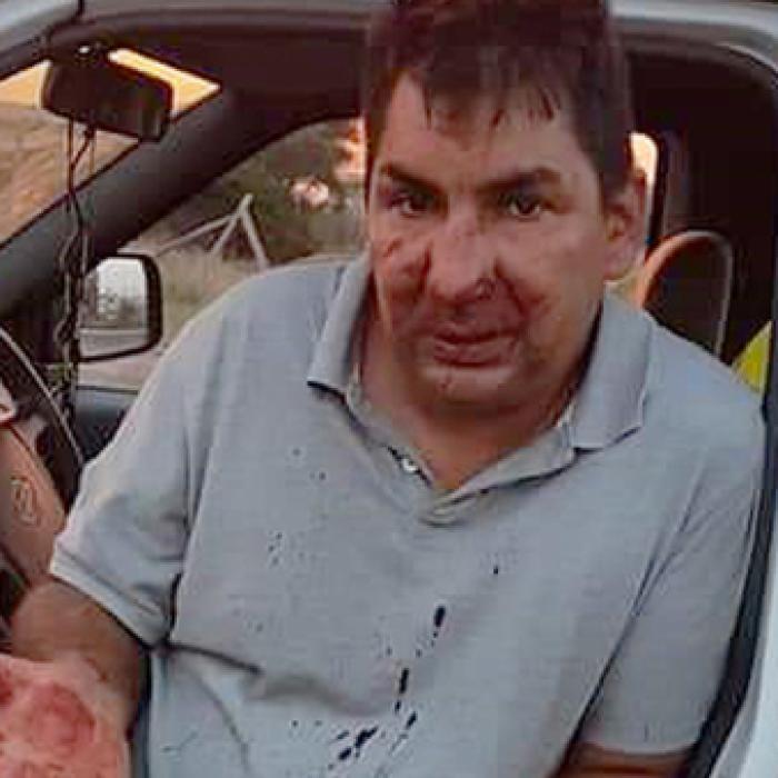 Român, bătut brutal de șapte italieni: S-au revoltat 