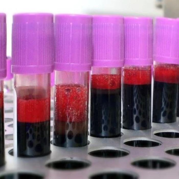 Alertă sanitară: Fiole cu sânge aruncate pe marginea unui drum public
