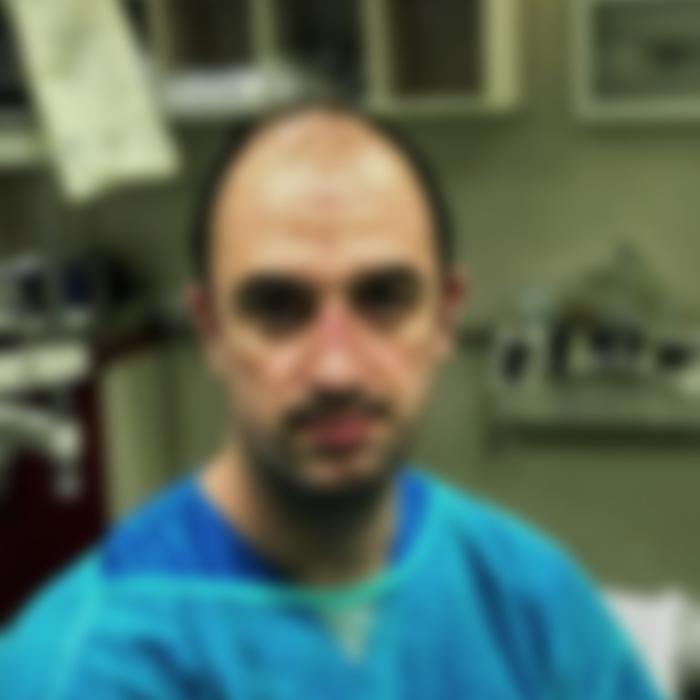 Imaginea unui asistent român după zeci de ore de muncă: obosit și cu semne adânci de la masca de protecție (FOTO)