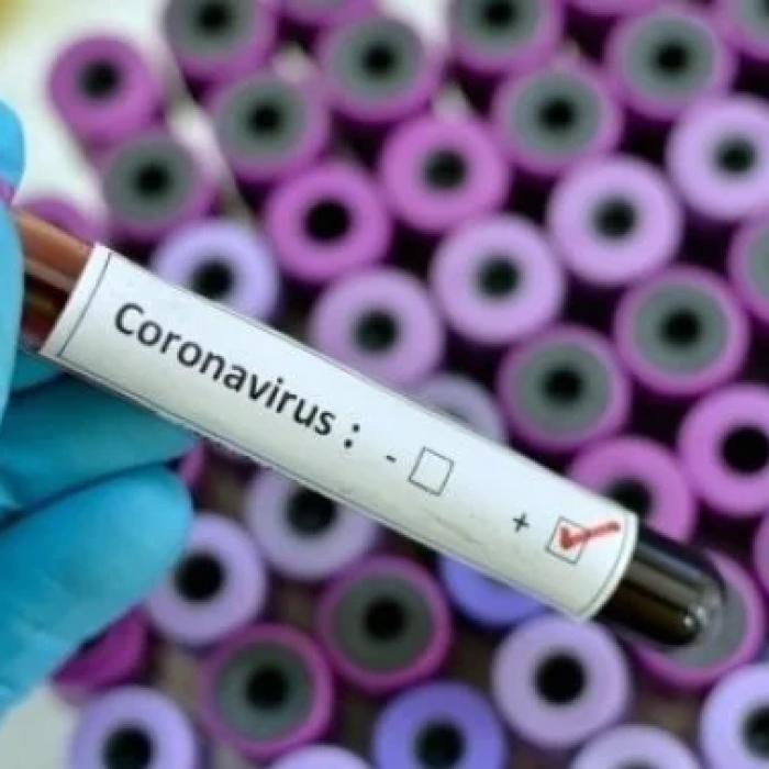 Italia. Studiul care răstoarnă tot ce se știa despre COVID: În februarie, 1 din 20 de milanezi avea deja anticorpi
