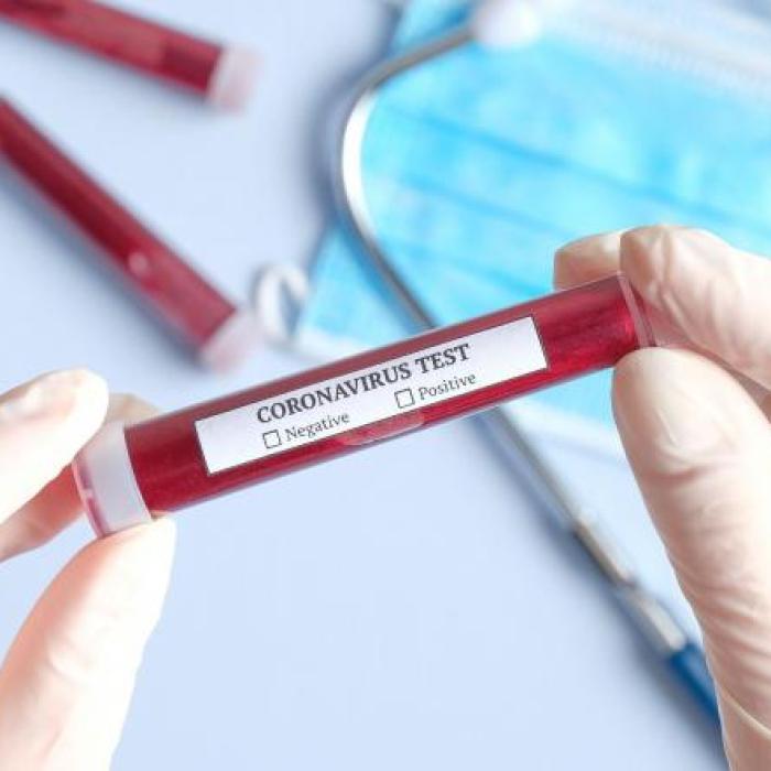 Încă un angajat MAE, pozitiv la testarea pentru COVID-19