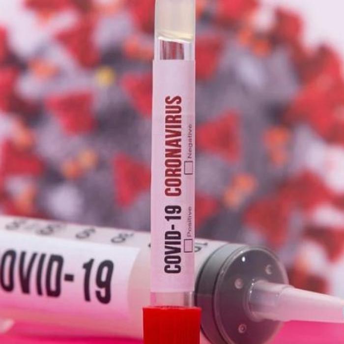 Bilanţ OMS. Infectările la nivel global au depăşit 17,8 de milioane, cu o creştere puternică în Columbia