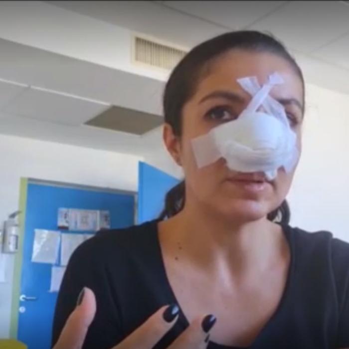 Agresoarea care a lovit-o pe Cristina Joia a fost reţinută de poliţişti