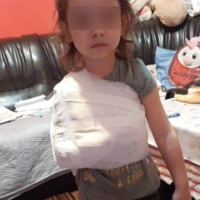 Caz șocant într-un spital din România: fetiță cu fractură, bandajată de medic peste tricou