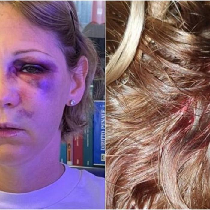 Italia. Româncă, bătută cu sălbăticie până la leșin, într-un supermarket. Nicoleta a refuzat avansurile unui italian