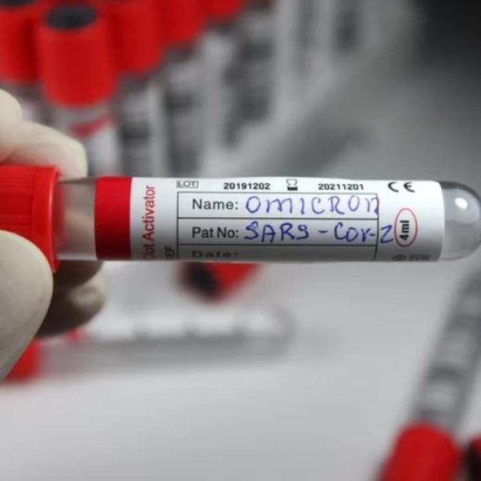 Marea Britanie raportează peste 88.000 de infectări noi cu COVID, un nou record