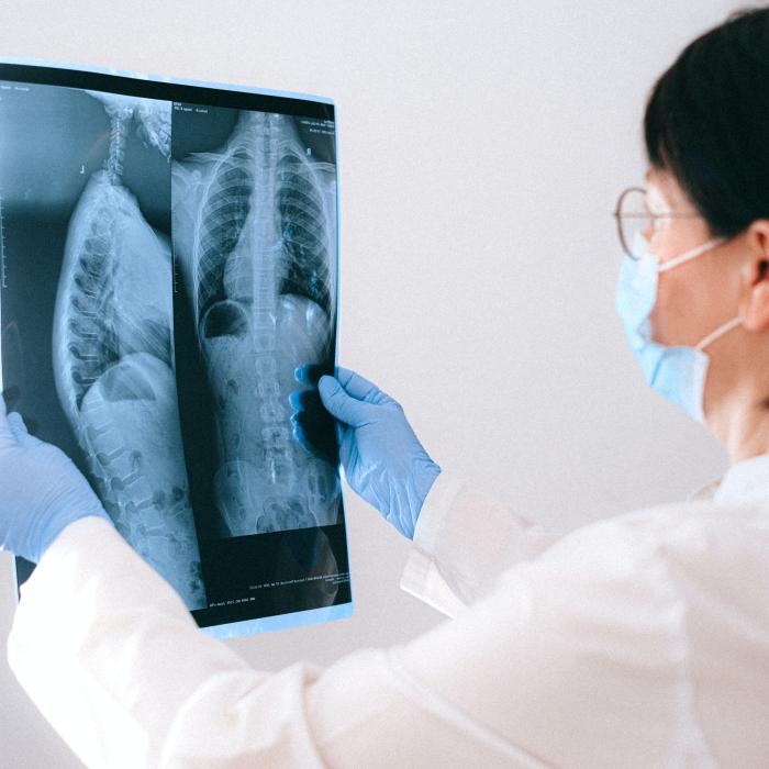 Reputat profesor doctor român: Facem radiologi foarte buni în România, nu avem puterea să-i ţinem în ţară