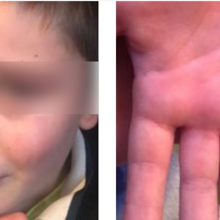 Învățătorul care a bătut un copil că nu știa tabla înmulțirii, lăudat de primar: „I-aș strânge mâna. Bătaia e ruptă din Rai!“