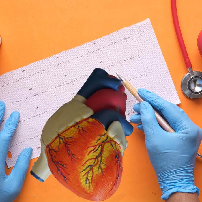 Atacul de cord: Care sunt simptomele; alimentele care trebuie evitate și meseriile cele mai expuse. Sfatul cardiologului