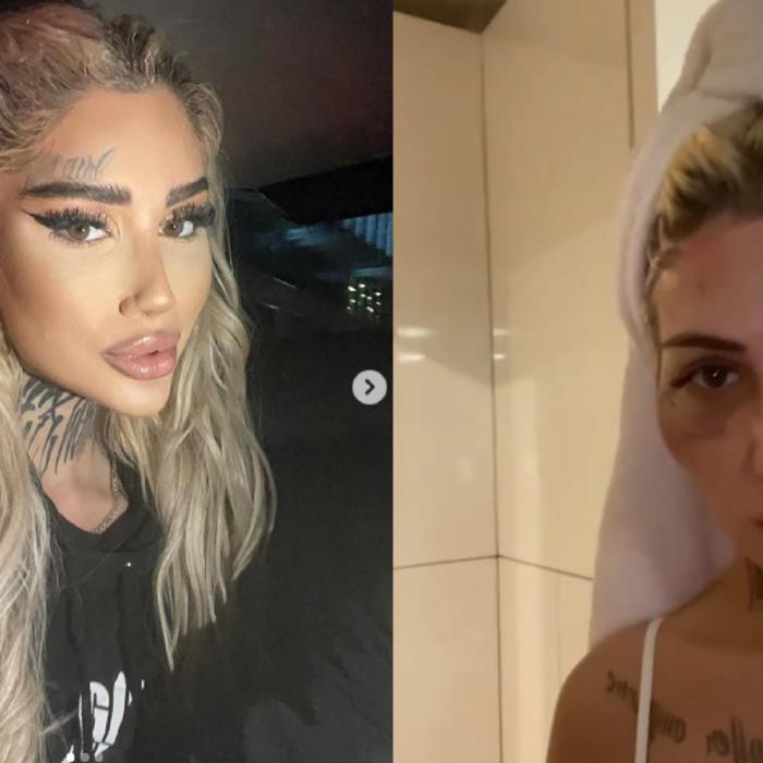 Bia Khalifa susține că a fost bătută de poliție: „Aici sunt umflată și vânătă” FOTO
