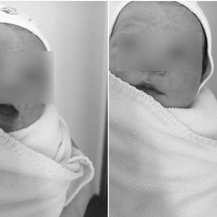 Doi părinți din Baia Mare își plâng bebelușul și îi acuză pe medici de malpraxis. "Am fost lăsată acasă 'sănătoasă'. Vă veghez dintre îngeri cu ochișorii mei albaștri"