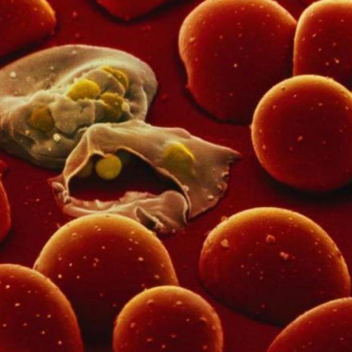 Avertismentul ministrului Sănătății: Sunt 9 cazuri de malarie în România. Atenție, boala poate fi confundată cu o infecție virală!
