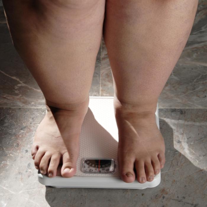 Studiu: obezitatea poate fi legată de o genă