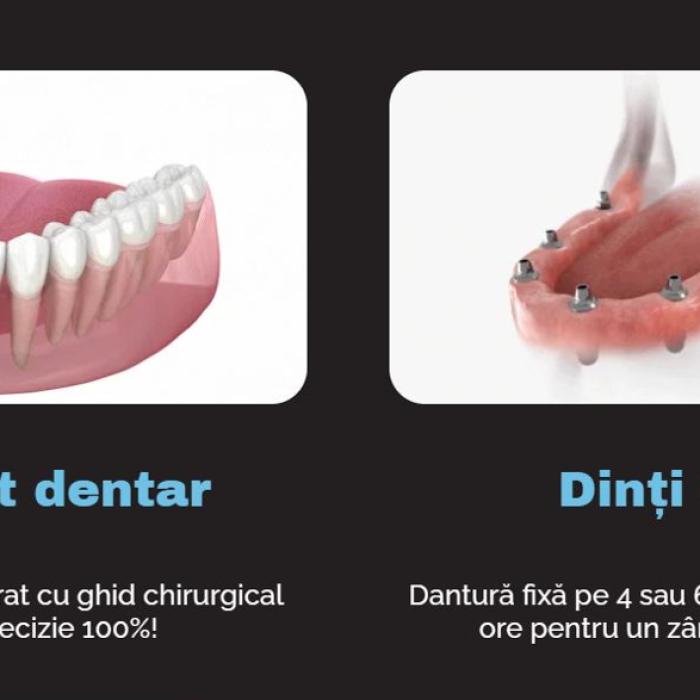 Analiza financiară care trimite diaspora în București pentru implanturi dentare și dantură fixă