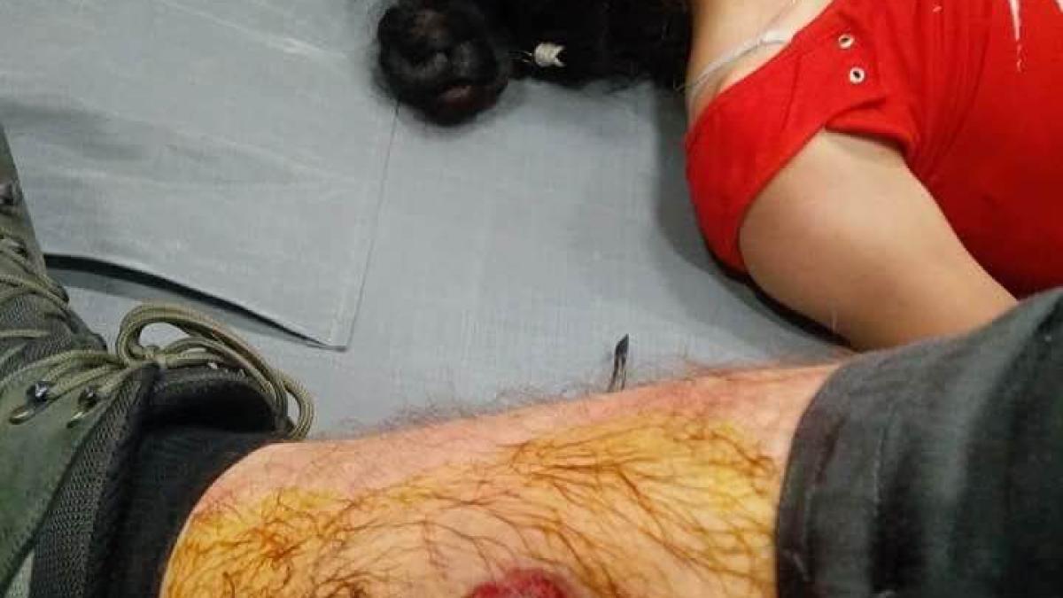 protest_grenada_picior