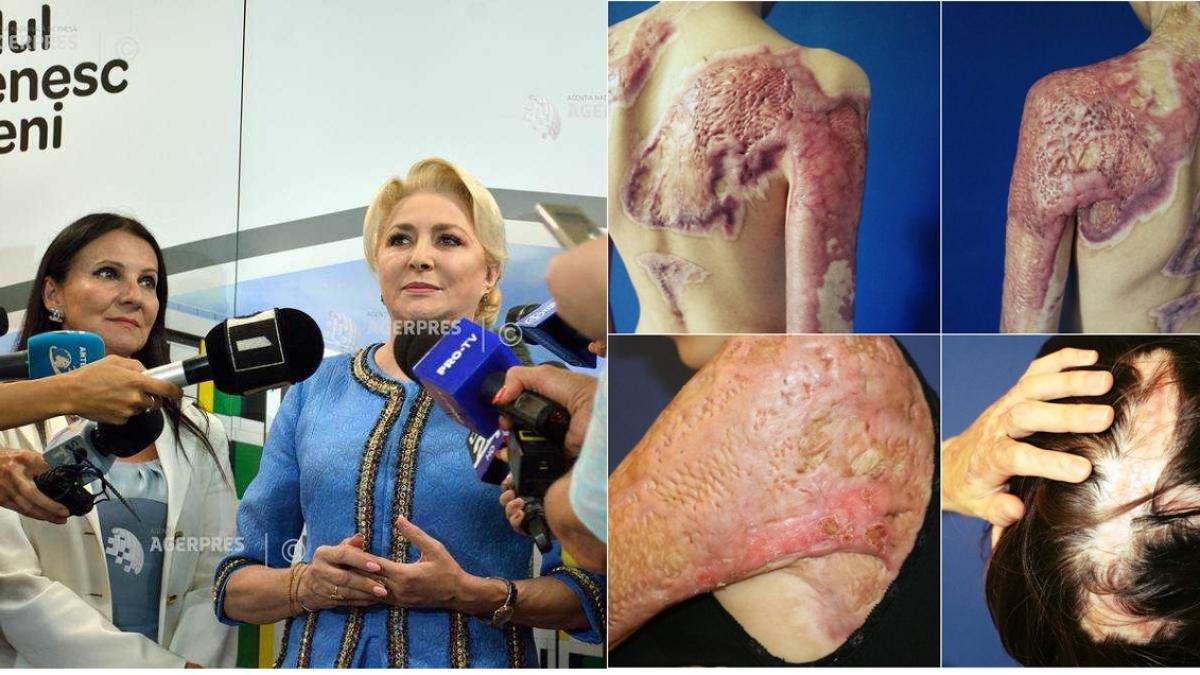 dancila_pintea_agerpres