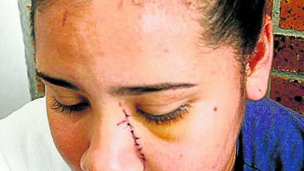 femeie_desfigurata_fata_taiata