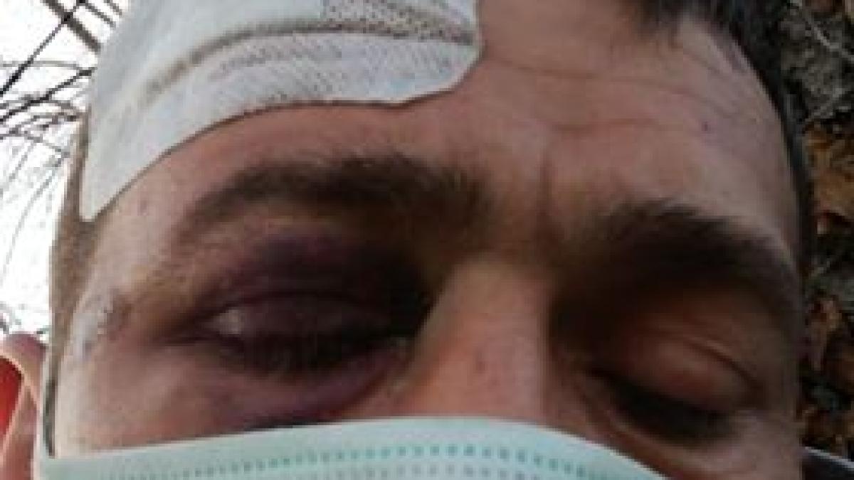 catalin_roman_batut_pe_strazi_ferrara_italia