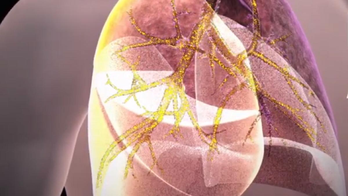 plamani_coronavirus_ilustrativ