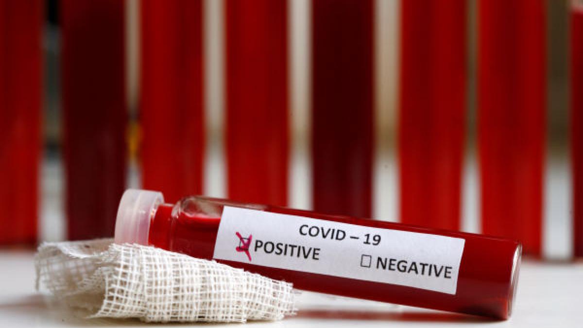 test_pozitiv_negativ_covid