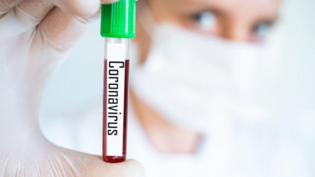 firmele-vor-oferi-angajatilor-teste-covid-19