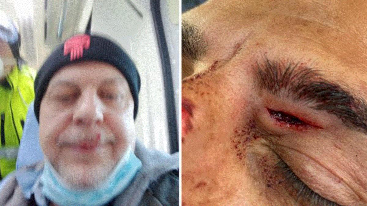 italia--patru-politisti-au-ajuns-la-spital--dupa-ce-au-fost-batuti-de-un-roman