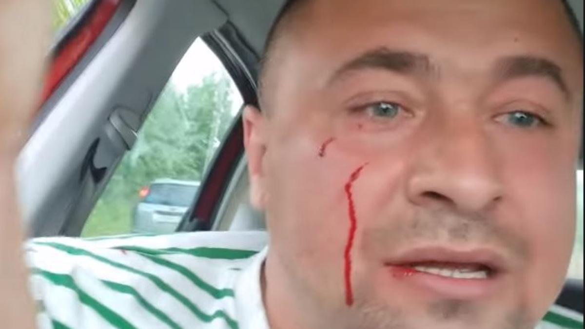 activist-din-buzau--batut-in-prezenta-a-doi-politisti--mi-am-dat-seama-ca-politia-nu-ma-protejeaza-cu-nimic