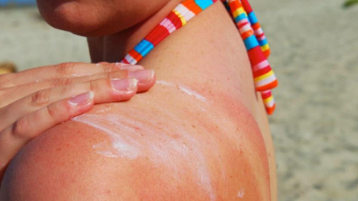 cum-sa-nu-te-arzi-la-soare-prc-c2prc-a0greseli-care-trebuie-evitate-imediat