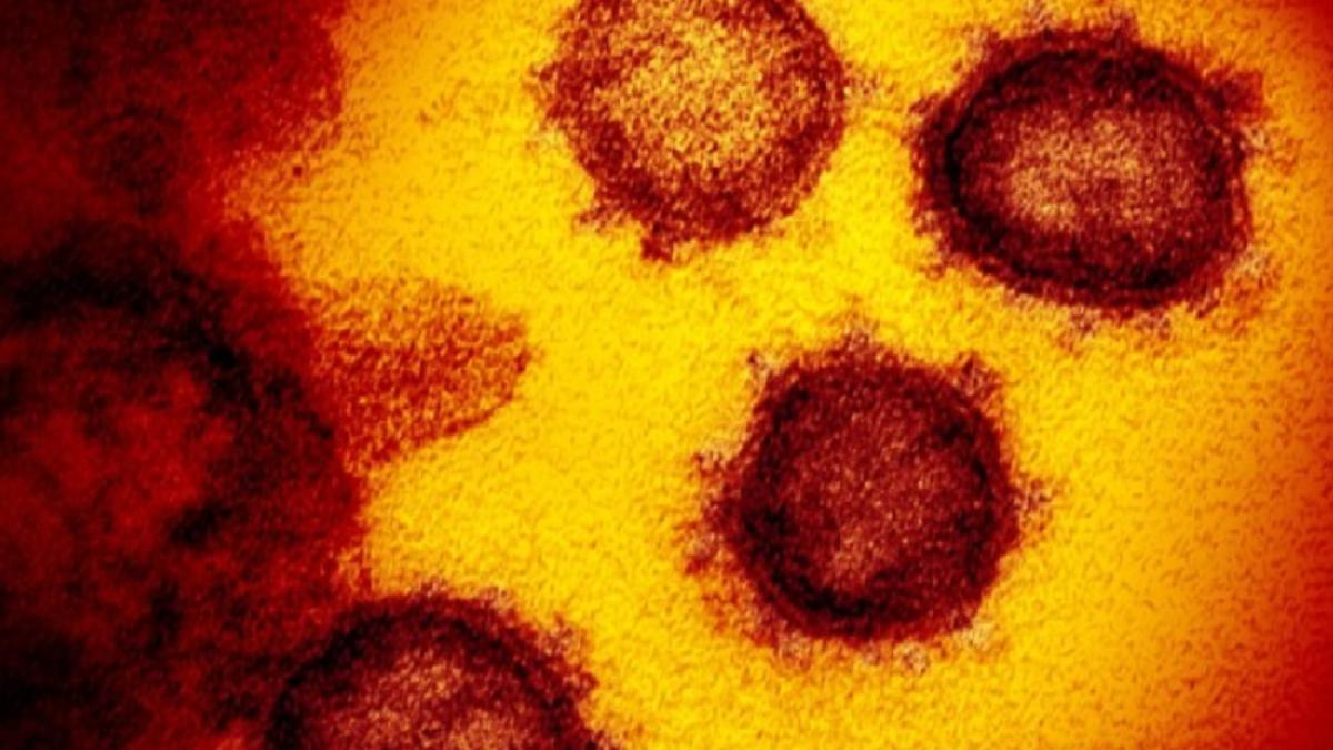coronavirus_vazut_microscop