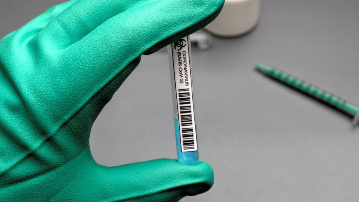 test_covid_coronavirus_ilustrativ_27_11_2020