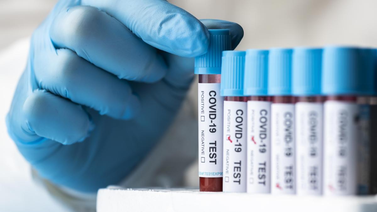 germania-vrea-sa-elimine-testele-covid-gratuite-pentru-a-incuraja-campania-de-vaccinare