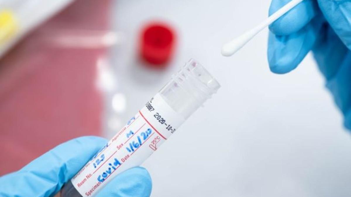 testarea-covid-19-se-va-face-si-in-farmacii