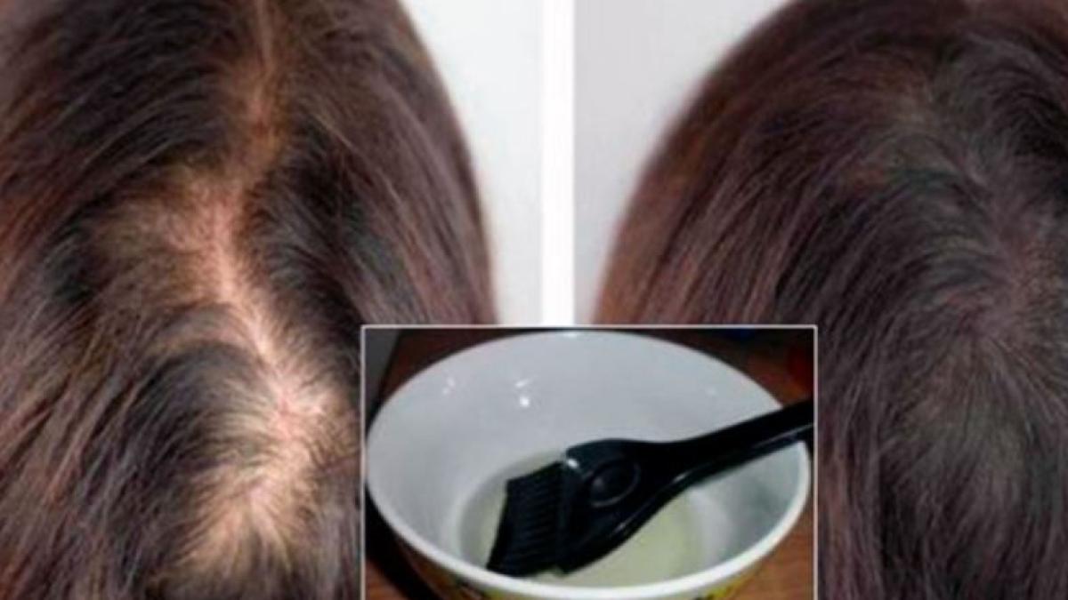 zdrobeste-usturoi-si-amesteca-cu-putin-gaz-lampant-si-ulei-de-ricin--aplica-pe-par-si-asteapta-o-ora--vei-fi-uimit-de-rezultat