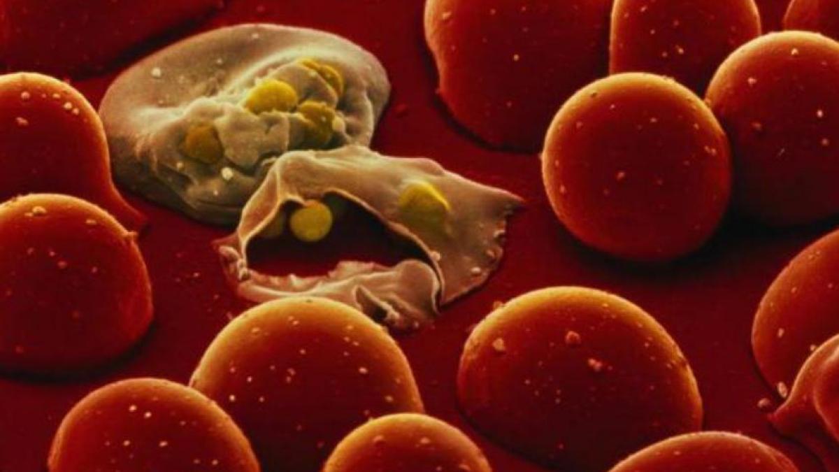 caz-sever-de-malarie--depistat-in-romania--pacientul-este-un-marinar--intors--recent--dintr-un-stat-din-africa-centrala