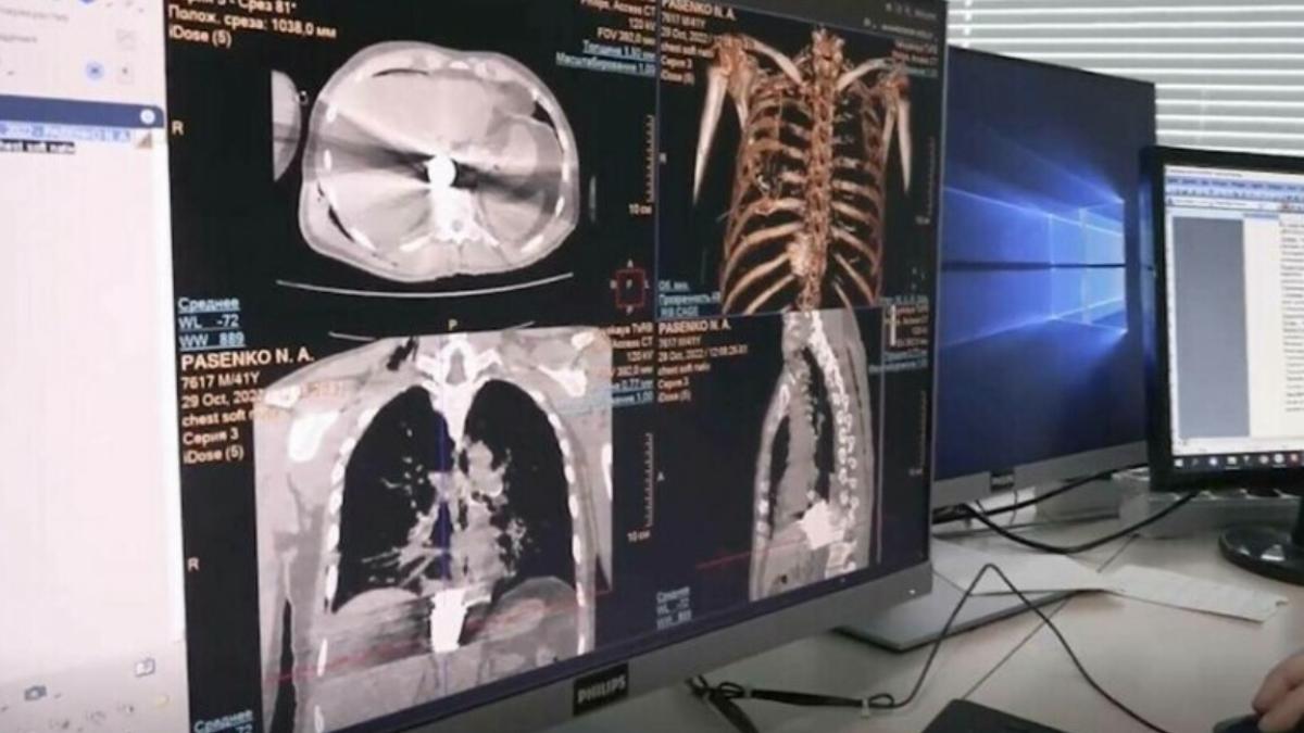 bomba-neexplodata-piept-soldat-rus