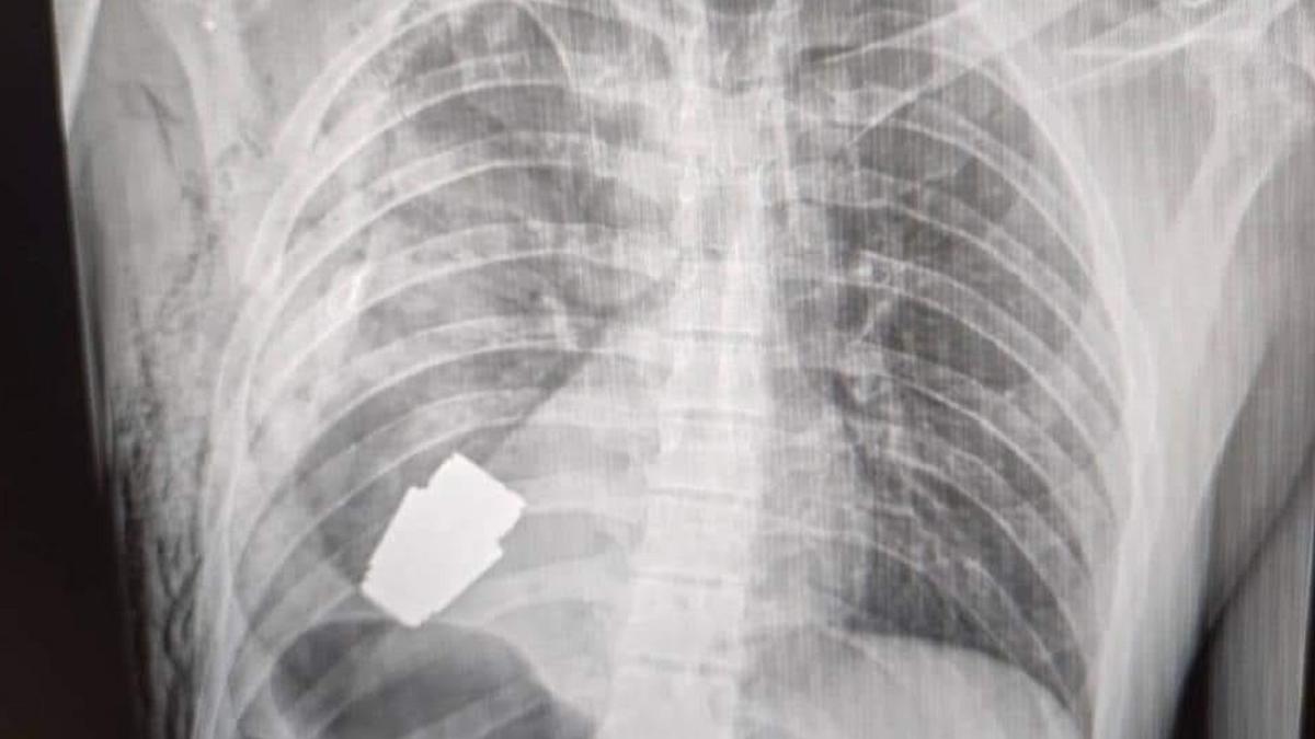 324181596_1205840206807447_6598515702553207153_n