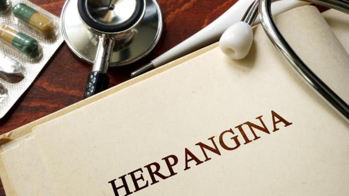 herpangina