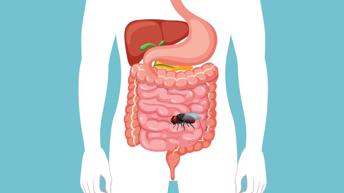 musca-intestin_59840800