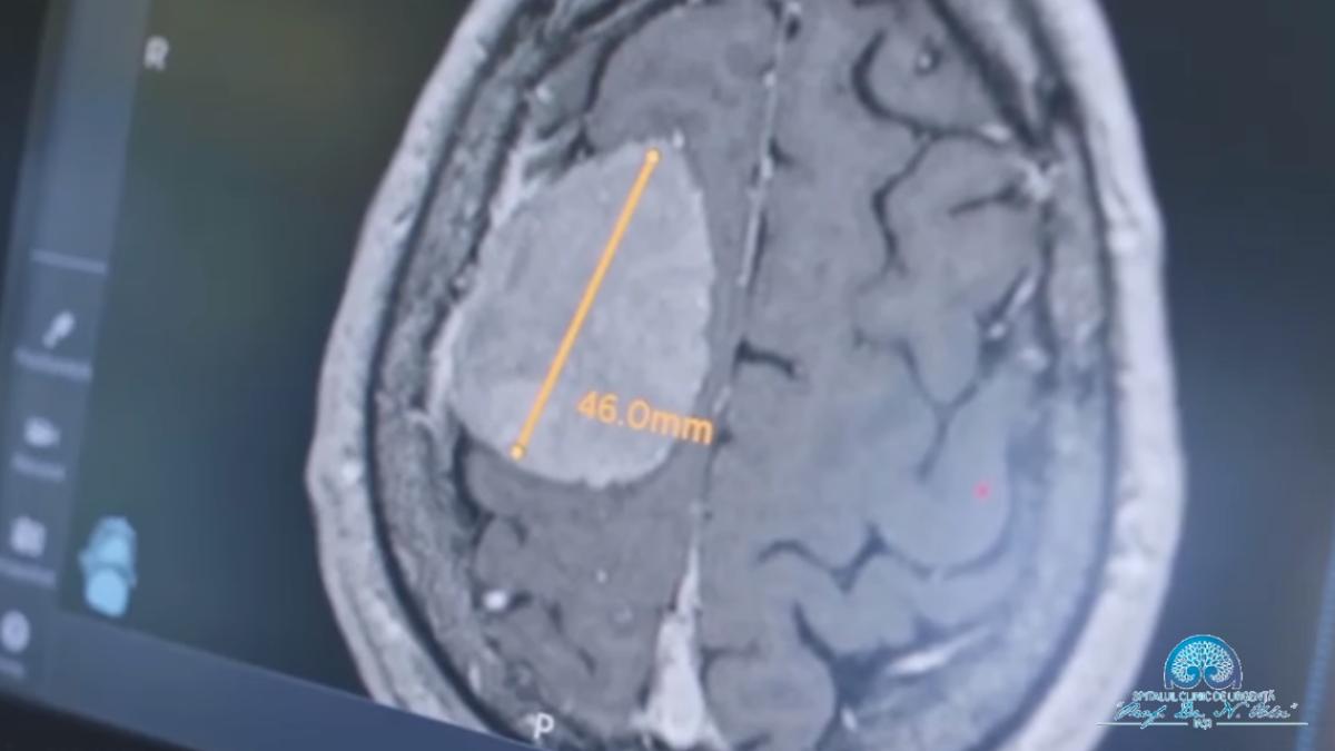 operatie-tumoare-spital-iasi_46702100