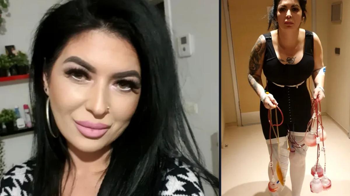 raluca-decedaata-operatii-turica_25500100