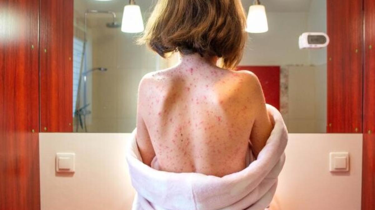 rujeola_07090300-freepik_53663500