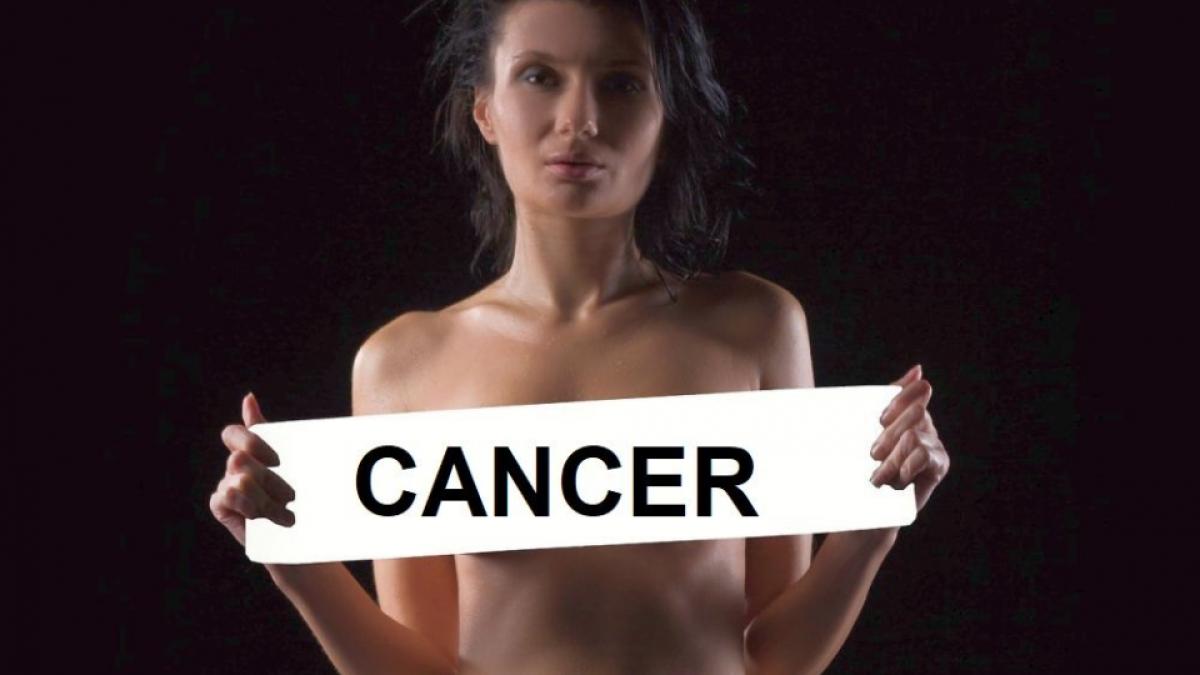 cancedr-de-san-pixabay_29555700