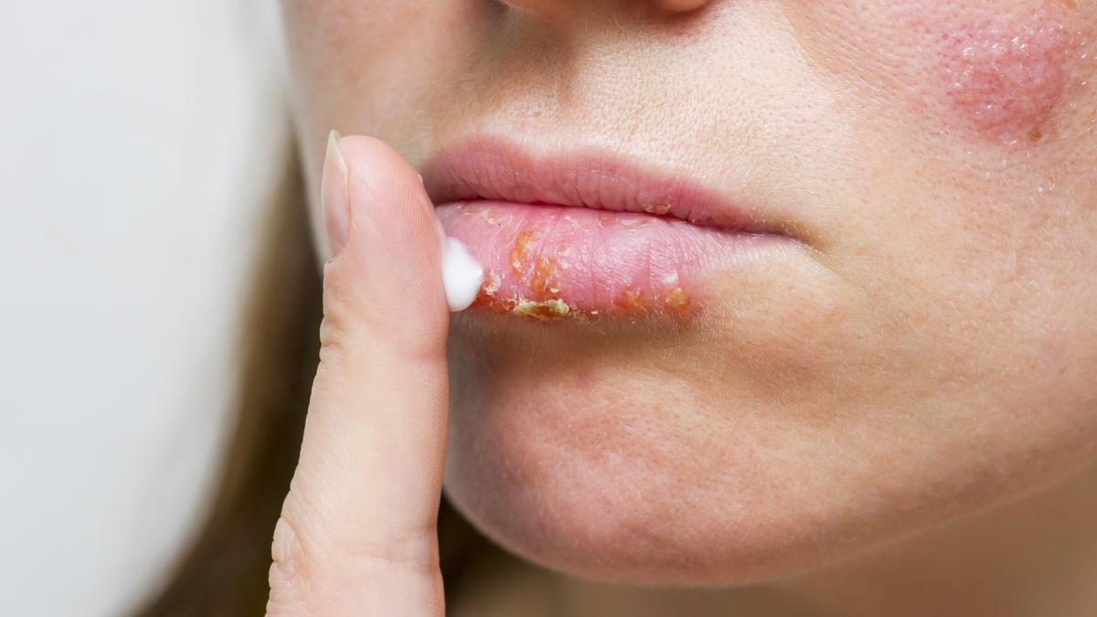 buze-crapate_49883500