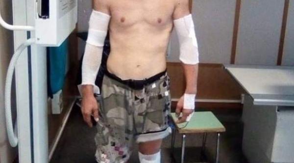 Explozie Italia. Românul care a supraviețuit miraculos: Acesta este motivul accidentului