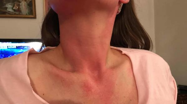  ȘOCANT. Cum arată o PREZENTATOARE TV  după ce a fost 'GAZATĂ' în Piața Victoriei