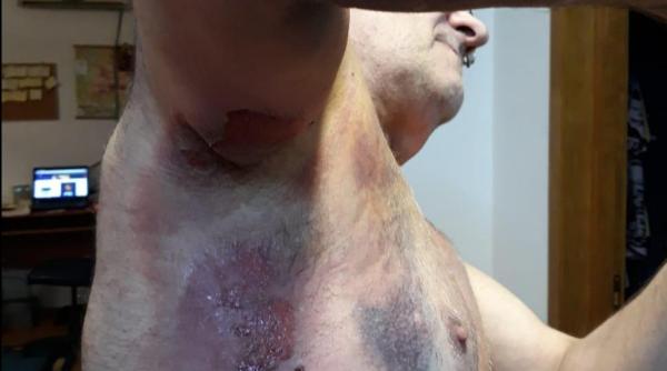 Medic pensionar bătut cu bestialitate de jandarmi