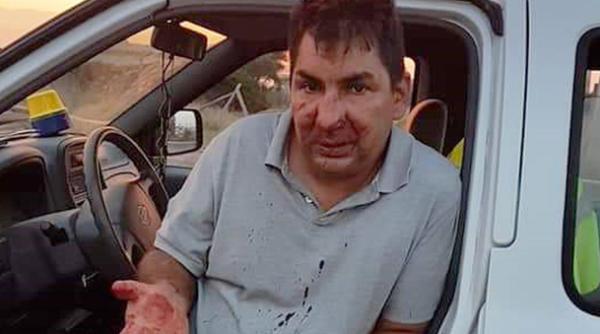 Român, bătut brutal de șapte italieni: S-au revoltat 