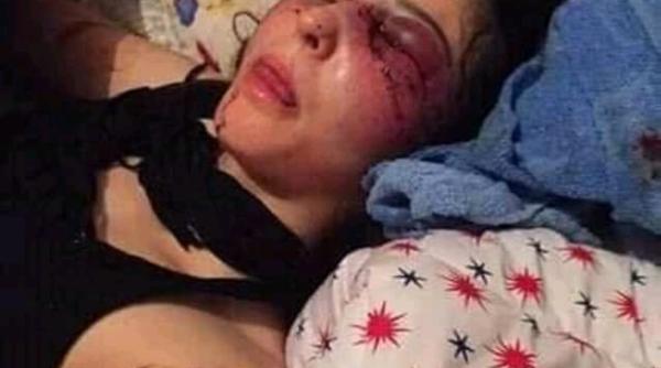 Petiție: Românii cer PEDEAPSA pe viață pentru Robert Gabriel, cel care și-a bătut cu bestialitate iubita