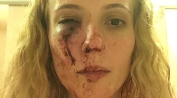 Marea Britanie: Româncă, BĂTUTĂ cu bestialitate de 10 englezi: Poliția nu a făcut NIMIC