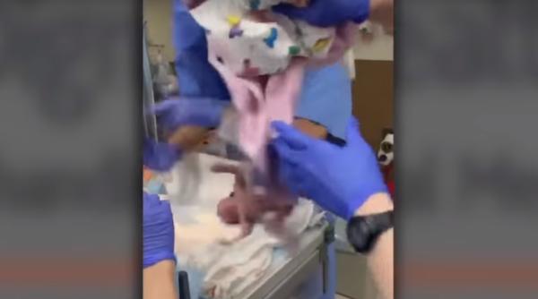 BEBELUȘ născut prematur, SCĂPAT de medici: „Mi-am ieșit din minți” (VIDEO)